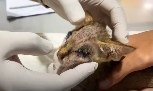 Both surgeries were successful. Although...