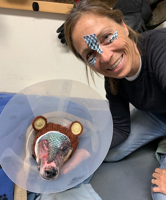 Dr. Oakley set up a specialized burn uni...