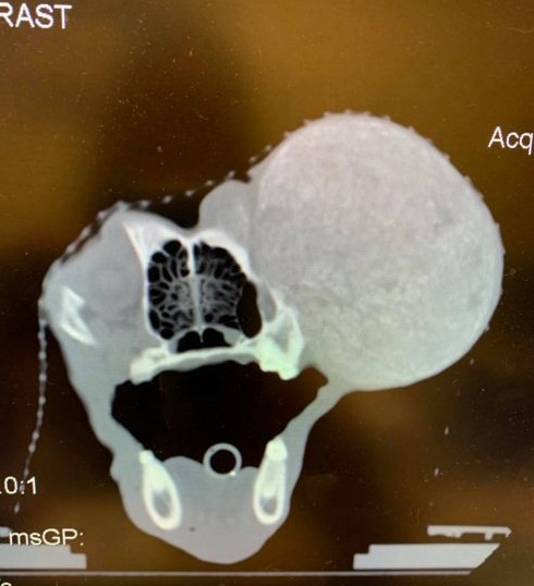 Although his time with his new family wa...