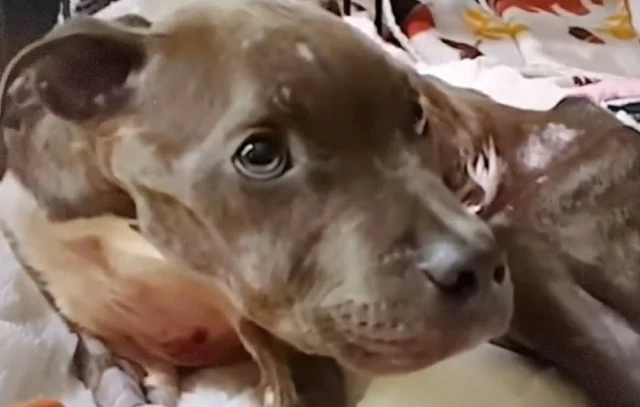 Teague faced a challenging road to recov...