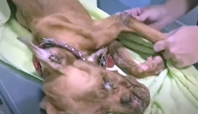 Battling severe anemia and sepsis, Baxte...