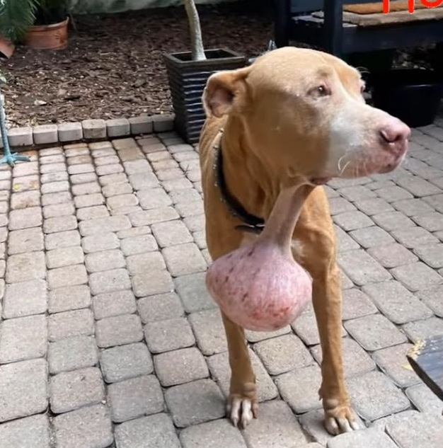 The successful removal of the tumor brou...