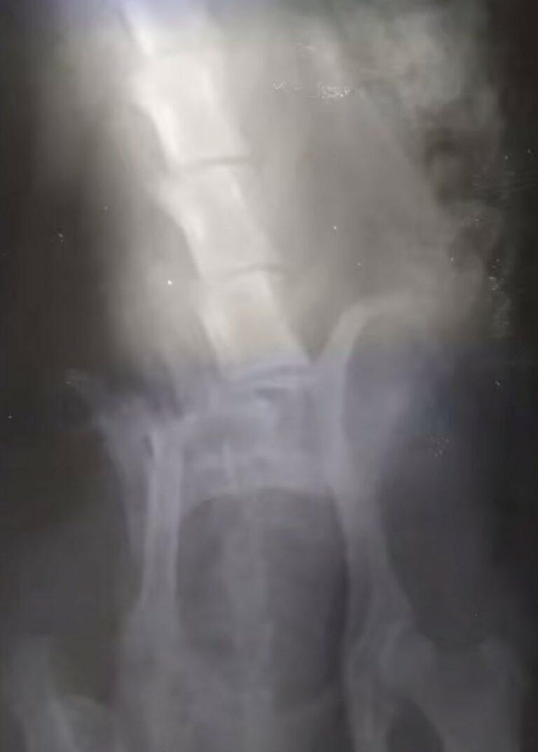 As for Mindy, the X-rays confirmed the w...